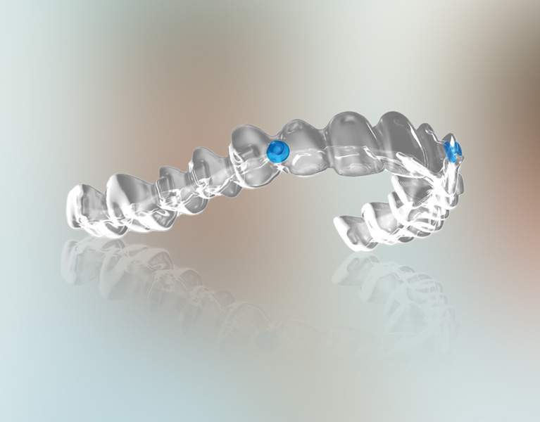 What are Angel Aligners?