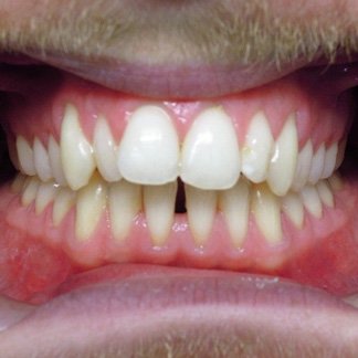 joseph-case-before-1